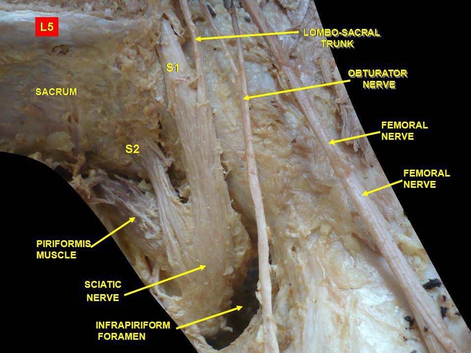 piriformis gross anatomy | EP Wellness Clinic ® • 915-850-0900