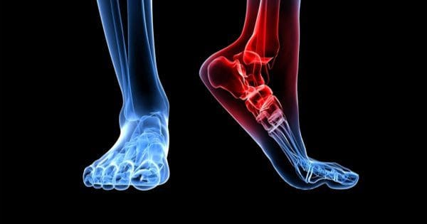 foot dysfunction chronic back pain el paso, tx.