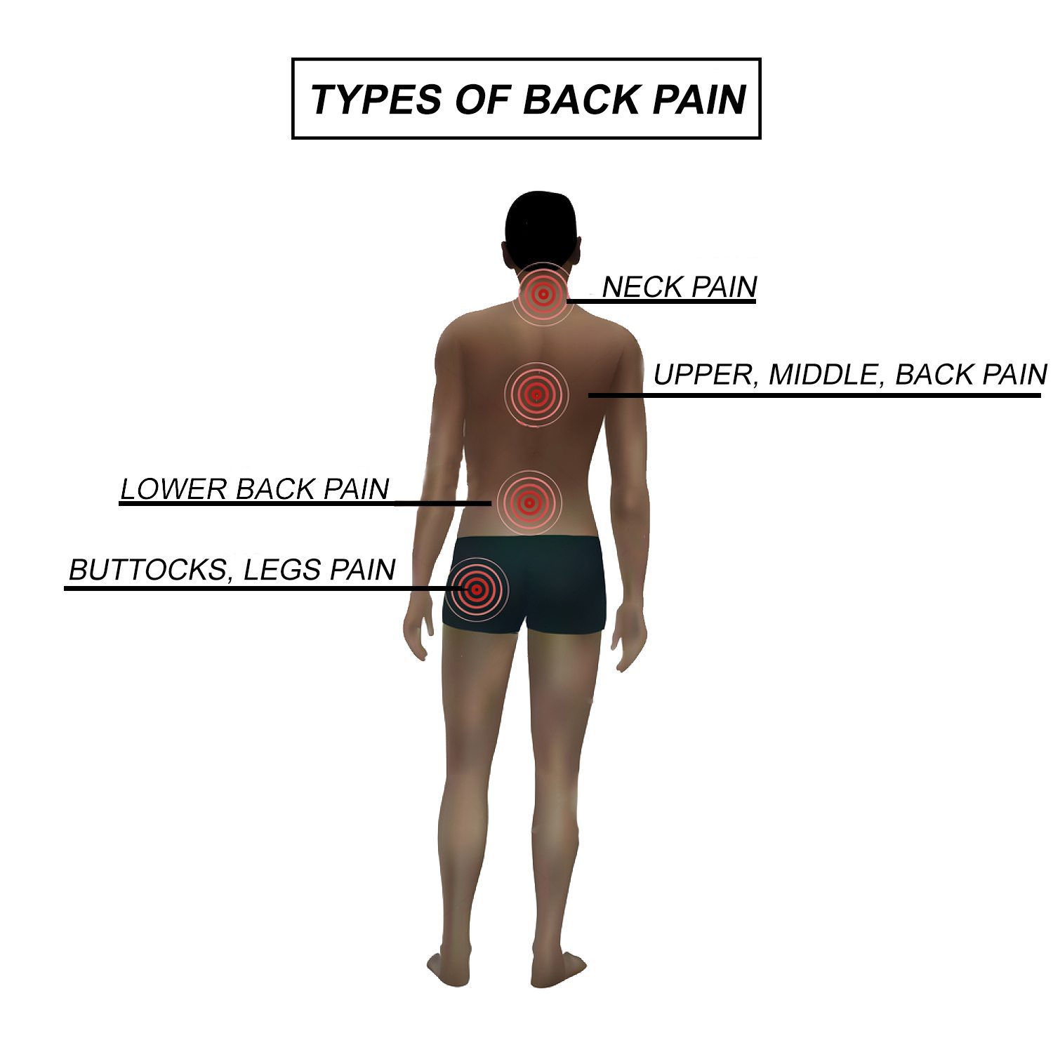 Back Pain Center: Upper, Mid & Lower Back - EP Wellness