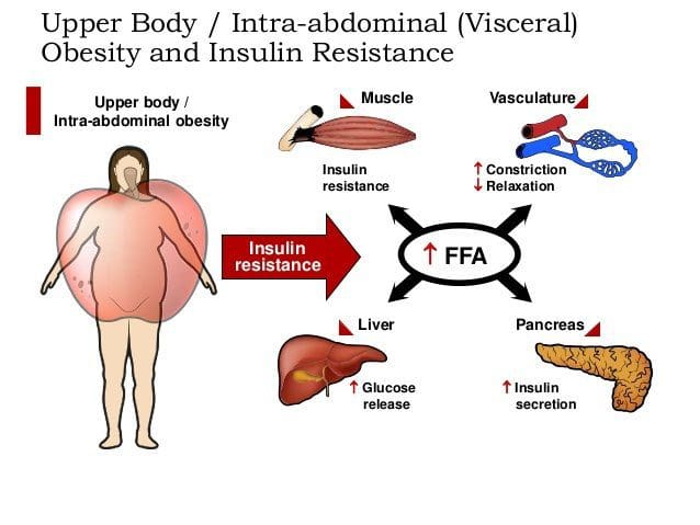 Insulin resistance что это