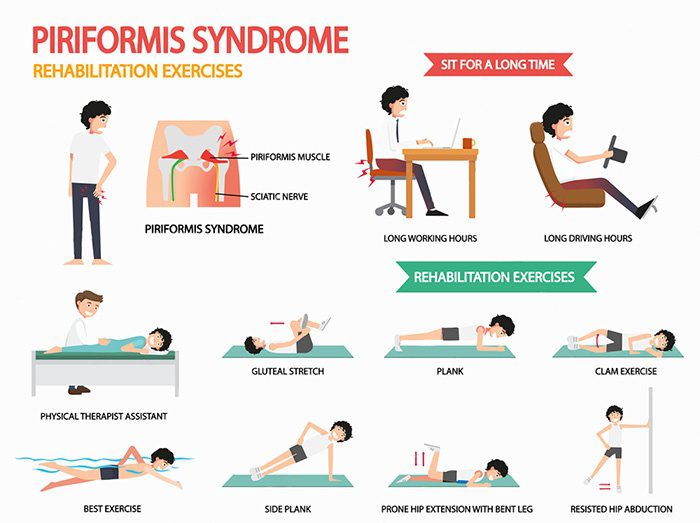 Relieve Piriformis Syndrome With Chiropractic Care