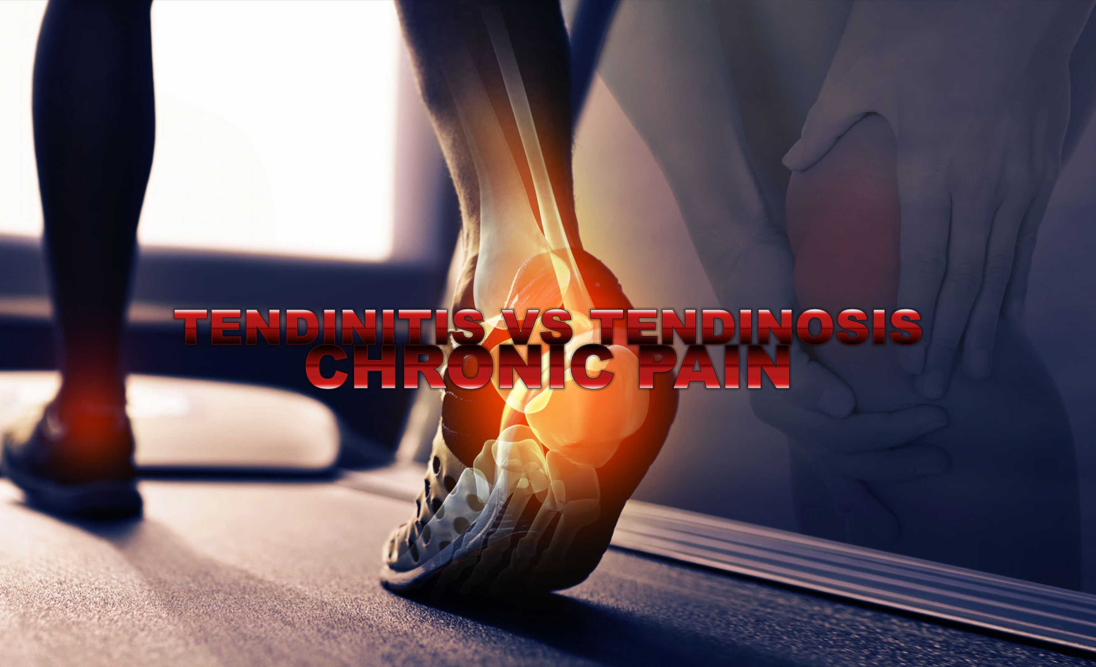 Tendinitis Vs Tendinosis Chronic Pain Ep Wellness Clinic