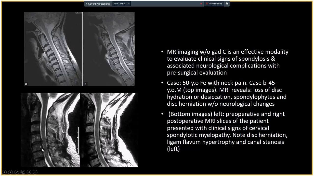 Spinal Arthritis Diagnostic Imaging Approach Part II EP Wellness