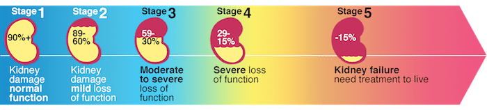 kidney-stages