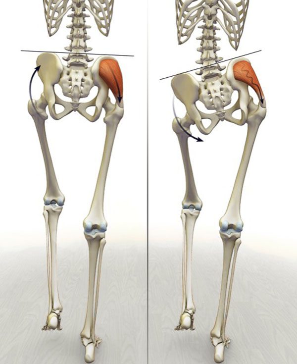 https://wellnessdoctorrx.com/wp-content/uploads/2020/10/imbalanced-hips-skeleton-tilt_02.jpg