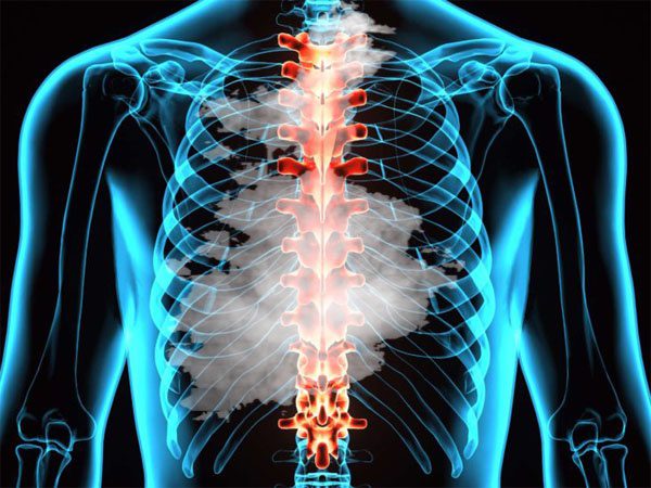 11860 Vista Del Sol, Ste. 128 Smoking Destroys The Spine and Can Cause Chronic Back Pain